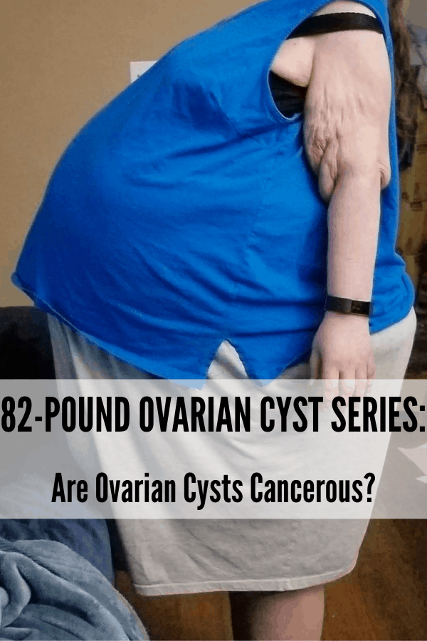 Picture of a person carrying an 82-pound ovarian cyst